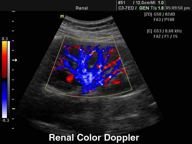 Renal Ultrasonography