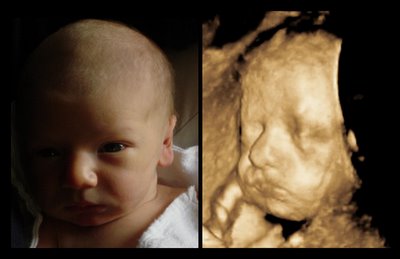 baby and ultrasound comparison